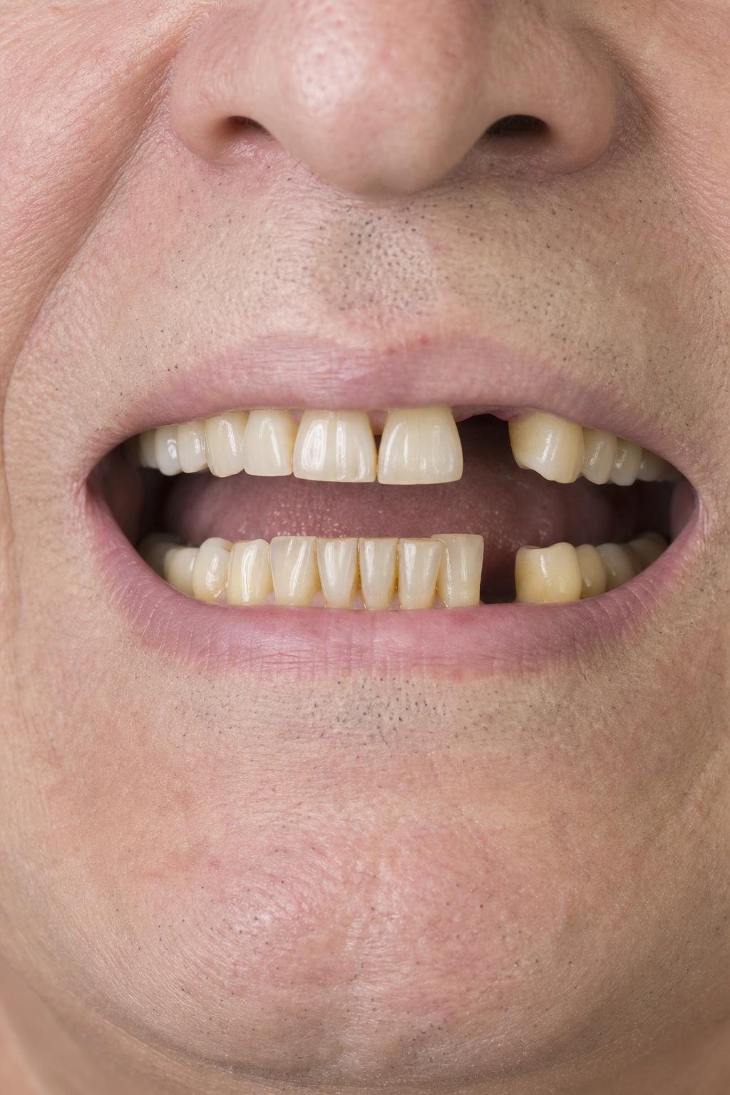 Before dental treatment 3